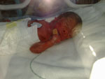 Baby 31
